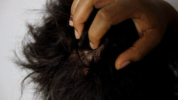 Can black people get lice?